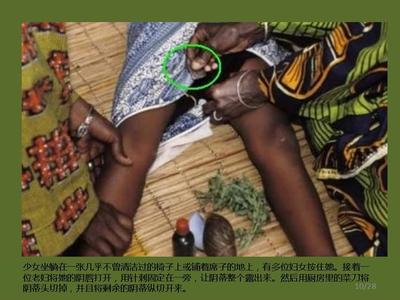 非洲少女割礼惨不忍睹 揭密无麻醉切除生殖器官酷刑(4)